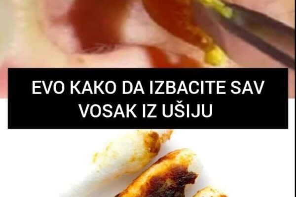 NIJE DOBRO KAD GA IMA PREVIŠE: IZBACITE SAV VOSAK JEDNOSTAVNO I BEZBOLNO, NE TREBAJU VAM ŠTAPIĆI ZA UŠI