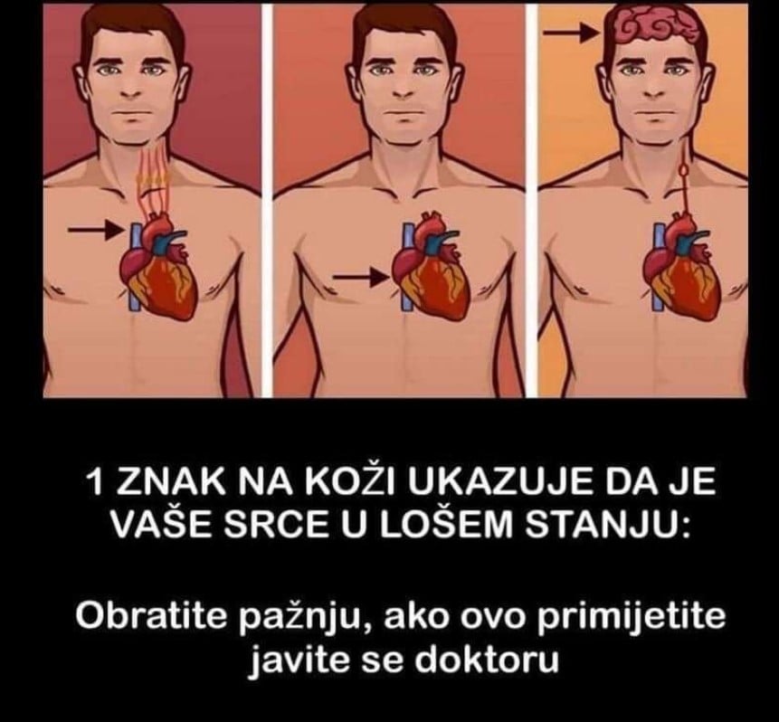 1 ZNAK NA KOŽI UKAZUJE DA JE VAŠE SRCE U LOŠEM STANJU: Obratite pažnju, ako ovo primijetite javite se doktoru