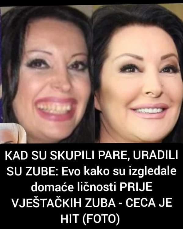 KAD SU SKUPILI PARE, URADILI SU ZUBE: Pogledajte poznate ličnosti prije vještačkih zuba, CECA I JELENA SU NAJVEĆE IZNENAĐENJE (FOTO)