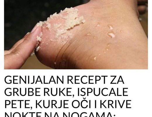 GENIJALAN RECEPT ZA GRUBE RUKE, ISPUCALE PETE, KURJE OČI I KRIVE NOKTE NA NOGAMA: Obavezno zapišite, nećete se pokajati