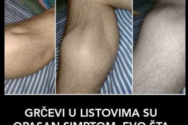 BUDE VAS NOĆU GRČEVI U LISTOVIMA? Organizam vas upozorava na opaku bolest, SIMPTOM KOJI NE SMIJETE IGNORISATI Share