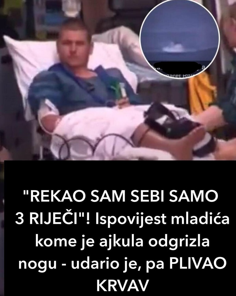 “REKAO SAM SEBI SAMO 3 RIJEČI”! Ispovijest mladića kome je ajkula odgrizla nogu – udario je, pa PLIVAO KRVAV!
