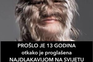 PROŠLO JE 13 GODINA Otkako Je Proglašena NAJDLAKAVIJOM NA SVIJETU: Evo Kako Ona Danas Izgleda, UDALA SE – NEMA NIJEDNU DLAKU NA LICU