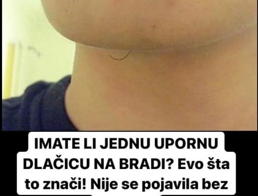 IMATE LI JEDNU UPORNU DLAČICU NA BRADI? Evo šta to znači! Nije se pojavila bez razloga