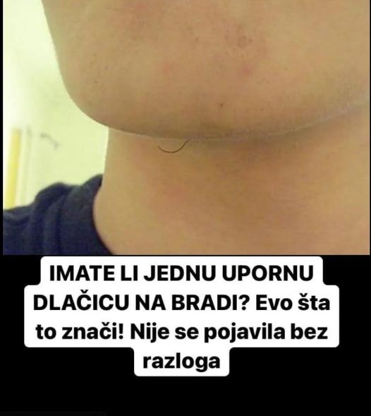 IMATE LI JEDNU UPORNU DLAČICU NA BRADI? Evo šta to znači! Nije se pojavila bez razloga