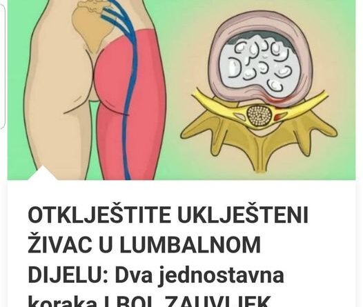 OTKLJEŠTITE UKLJEŠTENI ŽIVAC U LUMBALNOM DIJELU: Dva jednostavna koraka I BOL ZAUVIJEK NESTAJE!