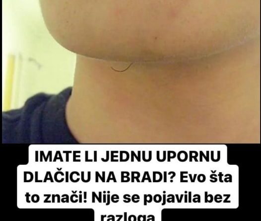 IMATE LI JEDNU UPORNU DLAČICU NA BRADI? Evo šta to znači! Nije se pojavila bez razloga