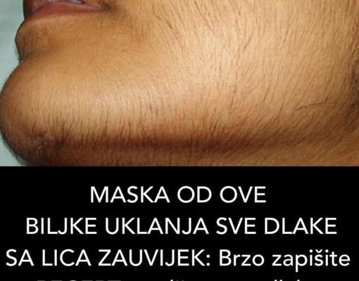 MASKA OD OVE BILJKE UKLANJA SVE DLAKE SA LICA ZAUVIJEK: Brzo zapišite RECEPT, poslije ovog dlake više ne rastu