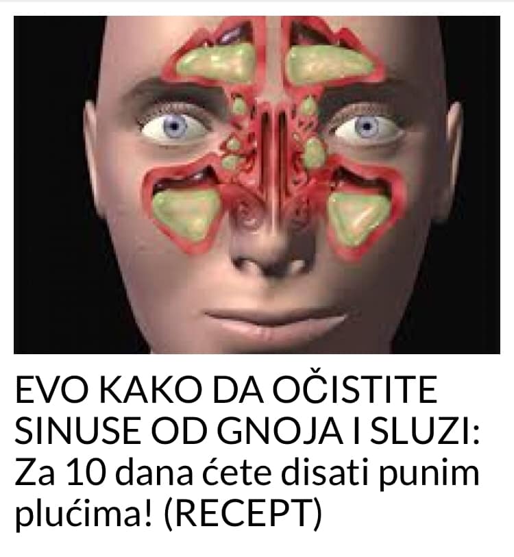 EVO KAKO DA OČISTITE SINUSE OD GNOJA I SLUZI: Za 10 dana ćete disati punim plućima! (RECEPT)