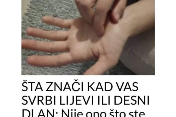 ŠTA ZNAČI KAD VAS SVRBI LIJEVI ILI DESNI DLAN: Sljedeći put ćete makar znati ŠTA VAS ČEKA!