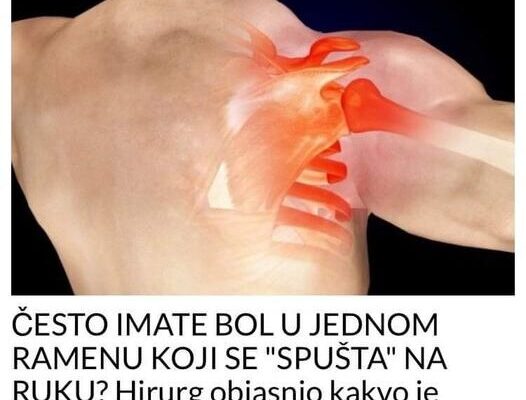 ČESTO IMATE B0L U JEDNOM RAMENU KOJI SE “SPUŠTA” NA RUKU? Hirurg objasnio kakvo je stanje u pitanju i da li je OPASN0