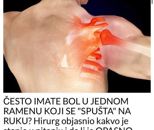 ČESTO IMATE B0L U JEDNOM RAMENU KOJI SE “SPUŠTA” NA RUKU? Hirurg objasnio kakvo je stanje u pitanju i da li je OPASN0