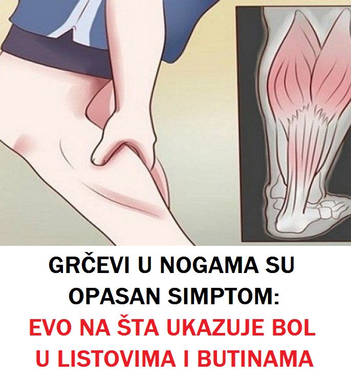 GRČEVI U NOGAMA SU OPASAN SIMPTOM: Evo na šta ukazuje bol u listovima i butinama!